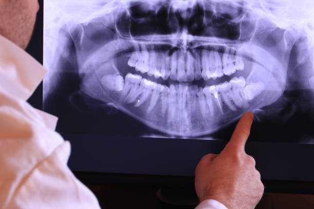 Best Urgent Tooth Repair  in Prophetstown, IL